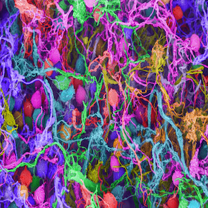الخلايا العصبية (التي تظهر في هذه الصورة الملتقَطة بواسطة المجهر الإلكتروني، وخضعت للتلوين الاصطناعي) تُصلح حمضًا نوويًا مكسورًا أثناء عملية تكوين الذكريات.